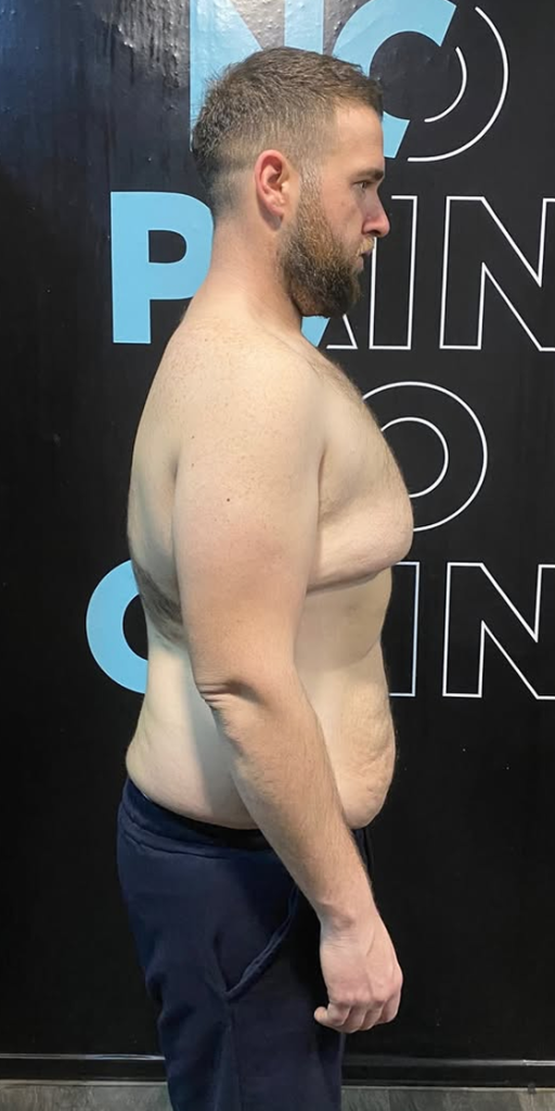 Transformacija 2 – POSLIJE