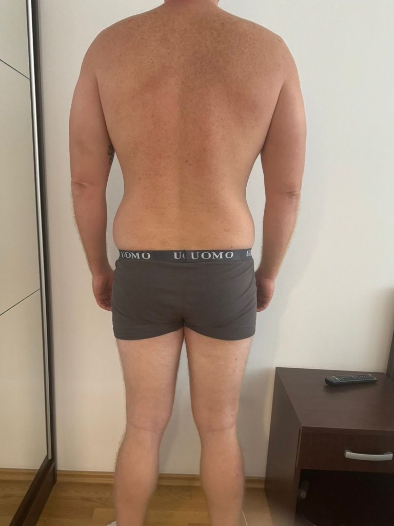 Transformacija 4 – PRIJE